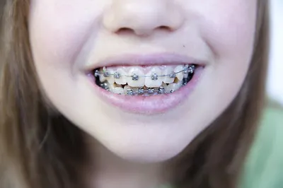 Ortodonta Gliwice NZOZ "ORTOM" S.C. Prywatna Poradnia Ortodontyczna